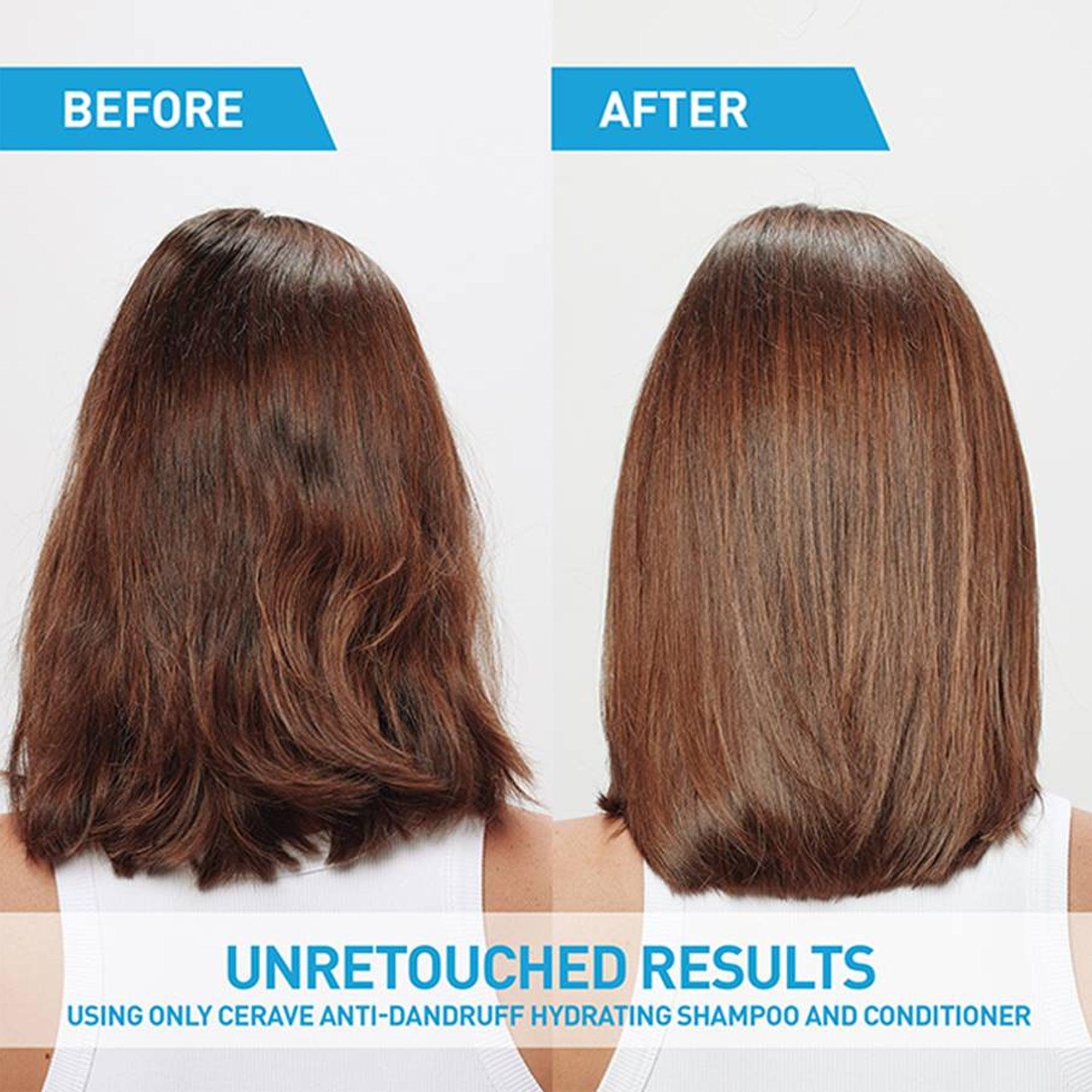 Cerave Anti-Dandruff Hydrating Conditioner 266ml