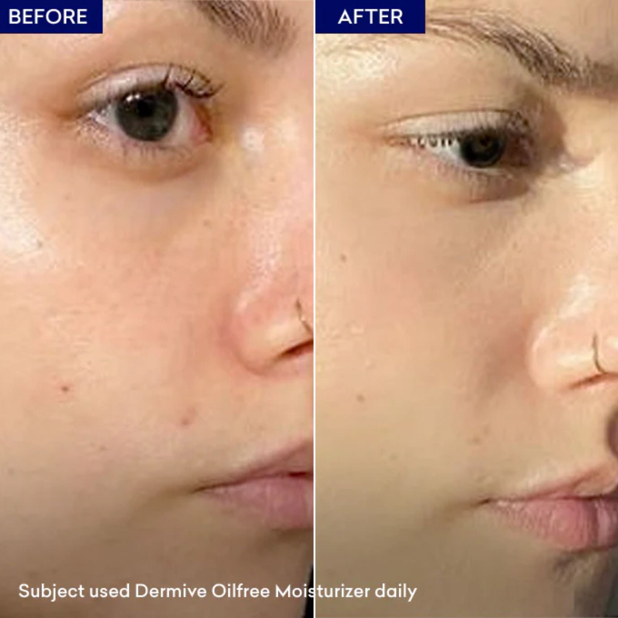 Jenpharm DermiVe Oil Free Moisturizer SPF20 100ml